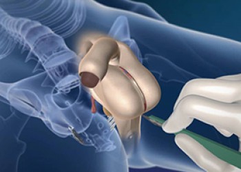 Επανορθωτική Χειρουργική Ουρολογία